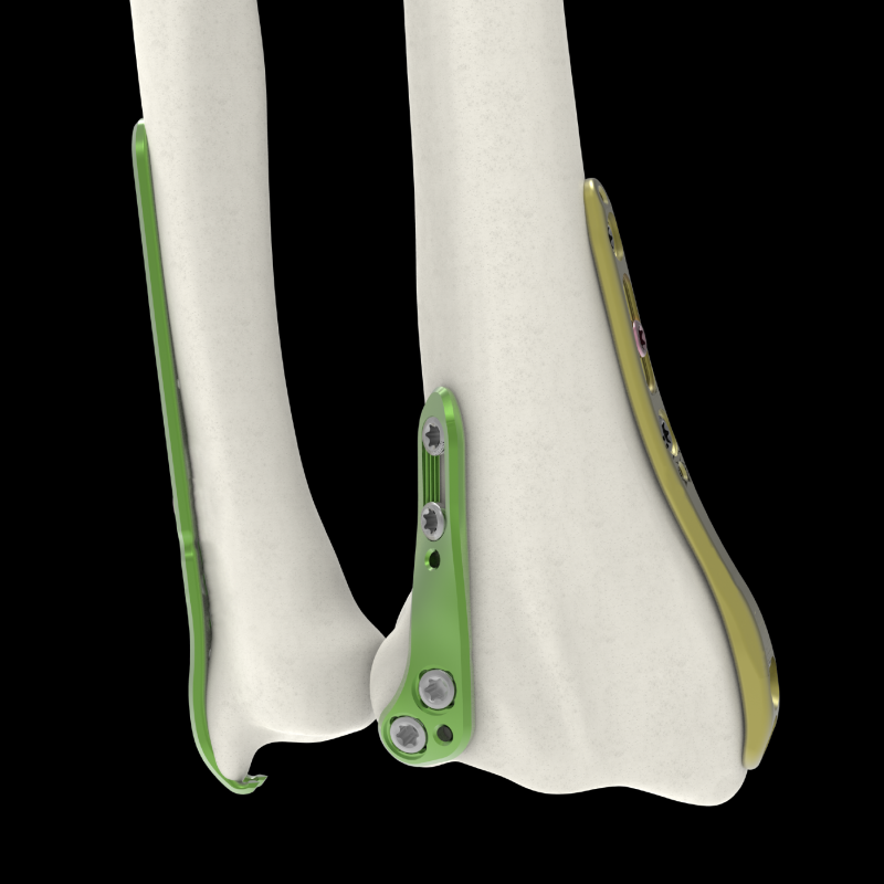 Placas - Fragmentos Especificos-07