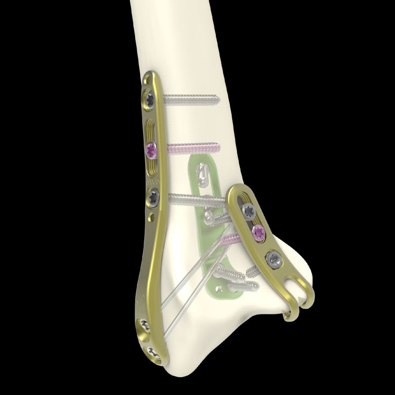 Placas - Fragmentos Especificos-08