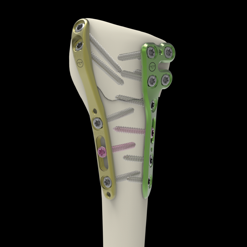 Placas - Fragmentos Especificos-12