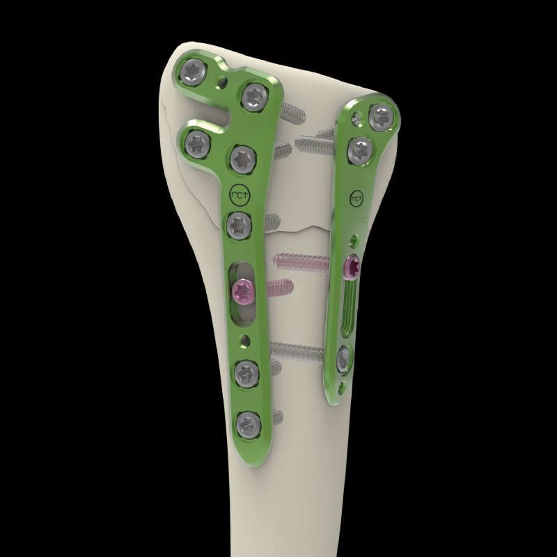 Placas - Fragmentos Especificos-13